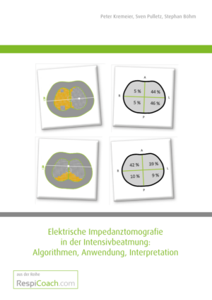 Elektrische Impedanztomografie in der Intensivbeatmung: Algorithmen, Anwendung, Interpretation